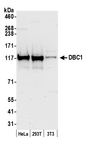 DBC1/p30 DBC Antibody in Western Blot (WB)