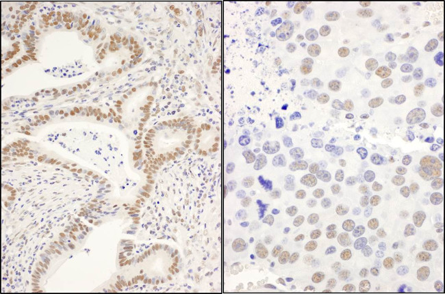 CCAR1 Antibody in Immunohistochemistry (Paraffin) (IHC (P))
