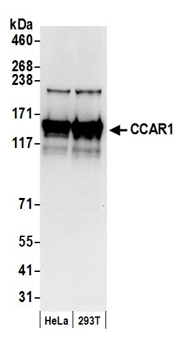 CCAR1 Antibody in Western Blot (WB)
