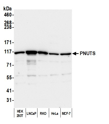 PNUTS Antibody in Western Blot (WB)