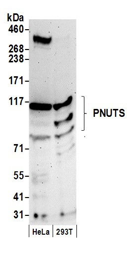 PNUTS Antibody in Western Blot (WB)