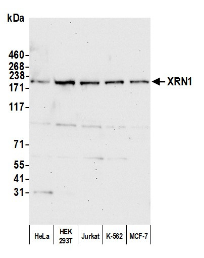 XRN1 Antibody in Western Blot (WB)