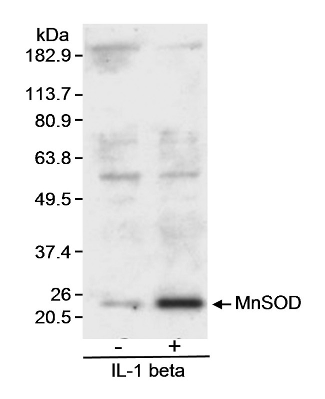 MnSOD Antibody in Western Blot (WB)