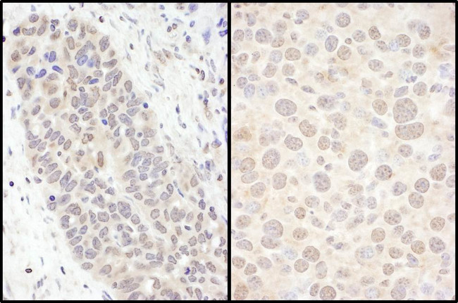 FOXO3a Antibody in Immunohistochemistry (Paraffin) (IHC (P))