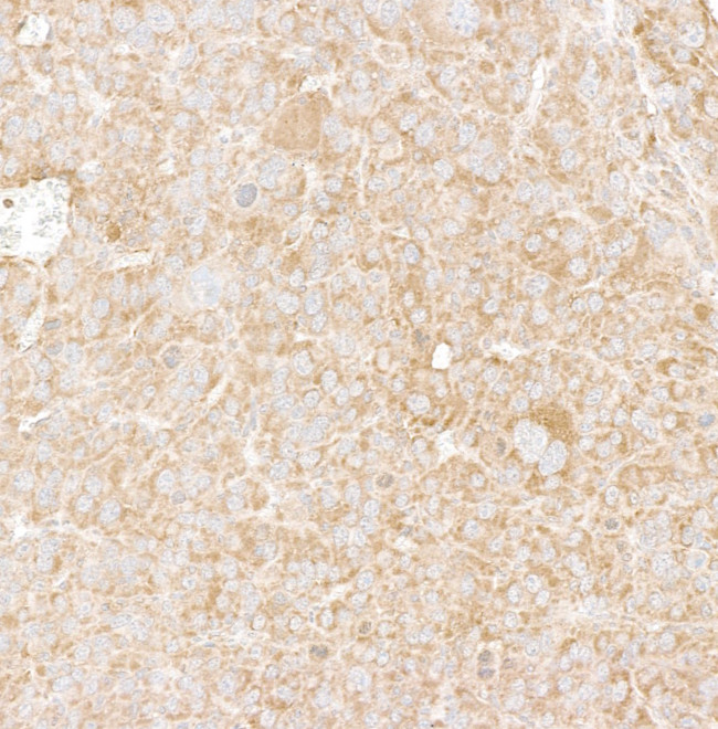 DDX6 Antibody in Immunohistochemistry (Paraffin) (IHC (P))