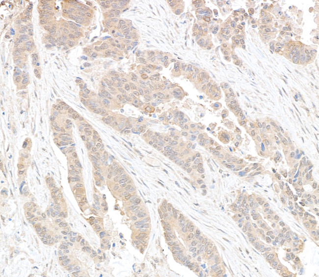 DDX6 Antibody in Immunohistochemistry (Paraffin) (IHC (P))