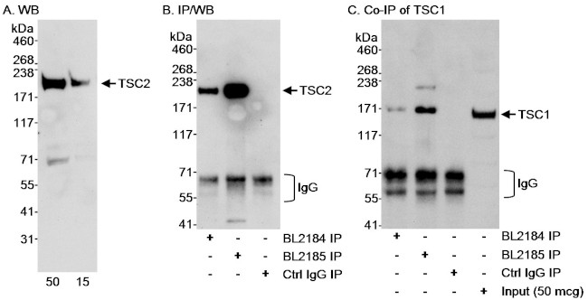 TSC2 Antibody in Western Blot (WB)
