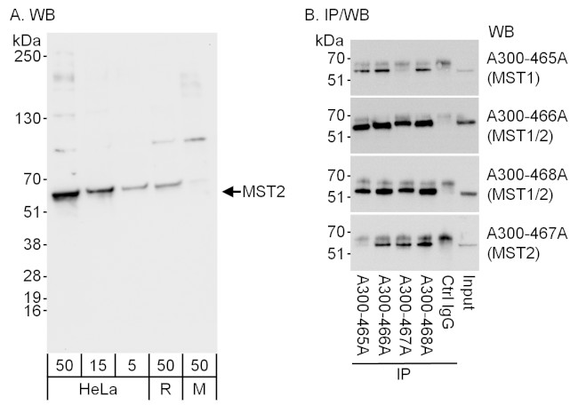 MST2/STK3 Antibody in Western Blot (WB)