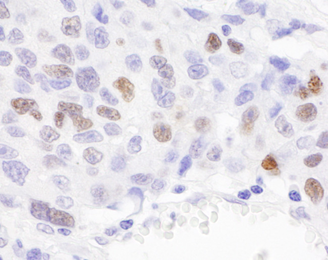 RCH1/KPNA2 Antibody in Immunohistochemistry (Paraffin) (IHC (P))