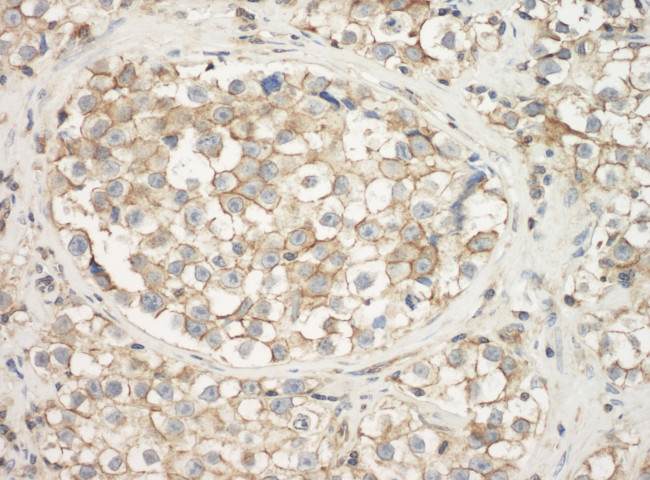 Cytoskeletal Actin Antibody in Immunohistochemistry (Paraffin) (IHC (P))