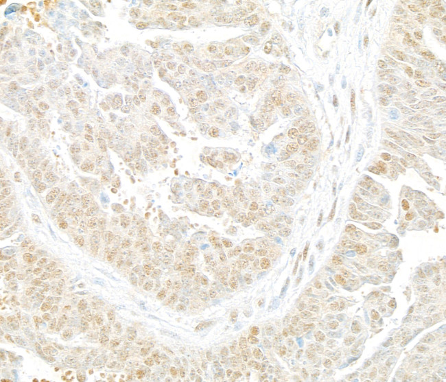 Lasu1/Ureb1 Antibody in Immunohistochemistry (Paraffin) (IHC (P))