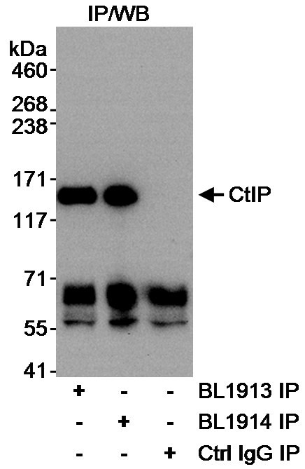 CtIP Antibody in Immunoprecipitation (IP)