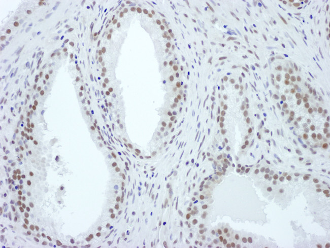 ASH2 Antibody in Immunohistochemistry (Paraffin) (IHC (P))