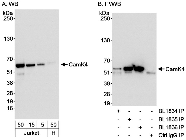 CamK4 Antibody in Western Blot (WB)