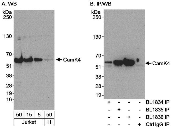 CamK4 Antibody in Western Blot (WB)