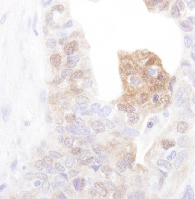 CamK4 Antibody in Immunohistochemistry (Paraffin) (IHC (P))