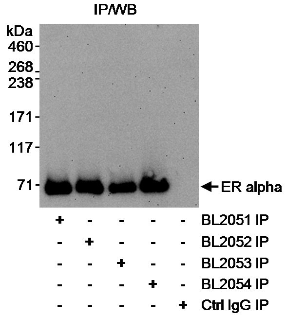 Estrogen Receptor Alpha Antibody in Immunoprecipitation (IP)