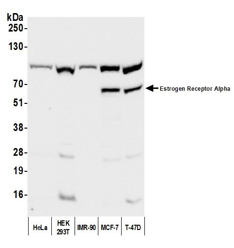 Estrogen Receptor Alpha Antibody in Western Blot (WB)