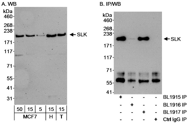 SLK Antibody in Western Blot (WB)