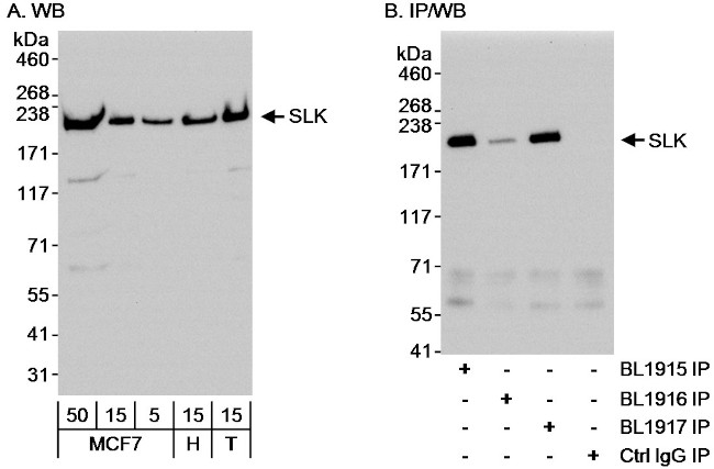 SLK Antibody in Western Blot (WB)