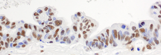hnRNP-H Antibody in Immunohistochemistry (Paraffin) (IHC (P))