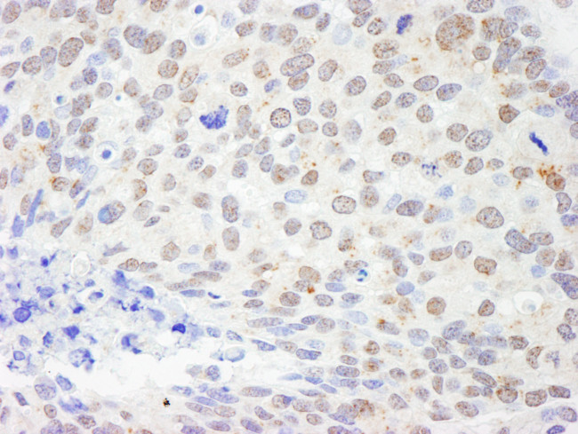 DDX1 Antibody in Immunohistochemistry (Paraffin) (IHC (P))