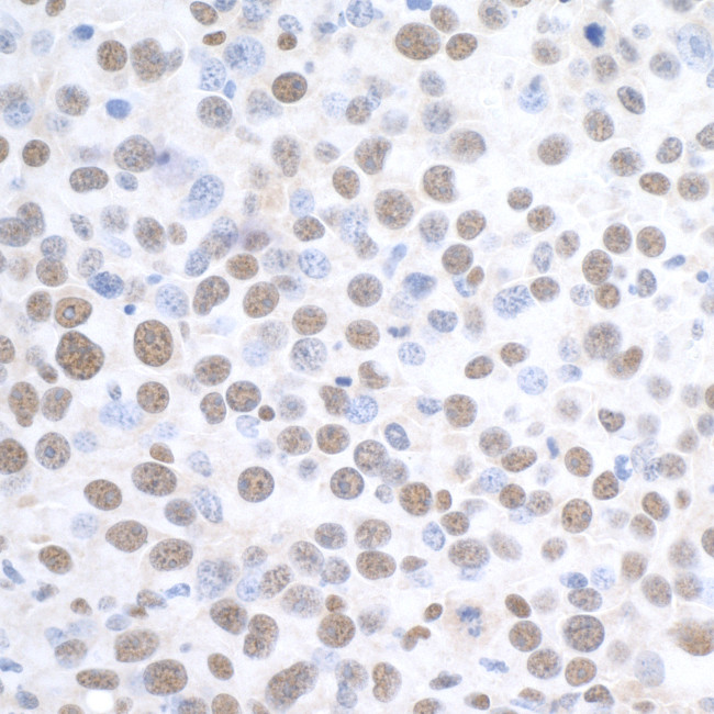 DDX1 Antibody in Immunohistochemistry (Paraffin) (IHC (P))