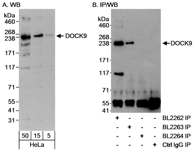 DOCK9 Antibody in Western Blot (WB)