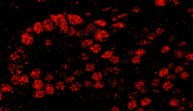 Pds5B Antibody in Immunohistochemistry (Paraffin) (IHC (P))