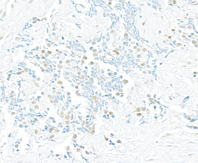 Pds5B Antibody in Immunohistochemistry (Paraffin) (IHC (P))