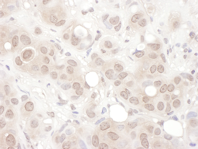 REST Antibody in Immunohistochemistry (Paraffin) (IHC (P))