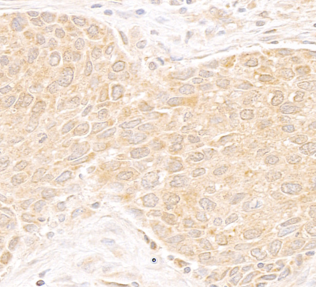 DDX19 Antibody in Immunohistochemistry (Paraffin) (IHC (P))