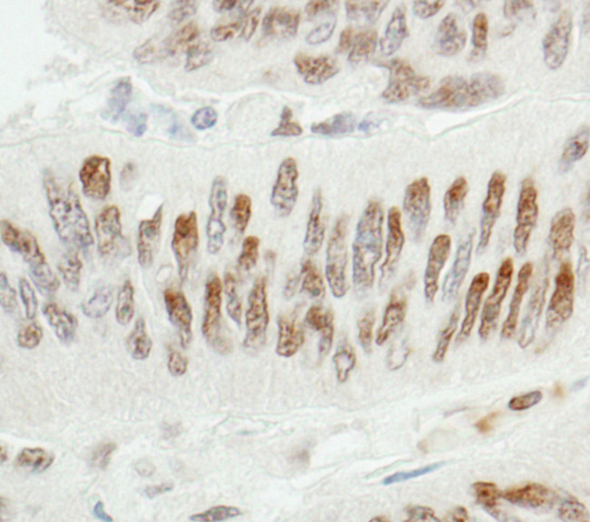 ZBTB7/FBI-1 Antibody in Immunohistochemistry (Paraffin) (IHC (P))