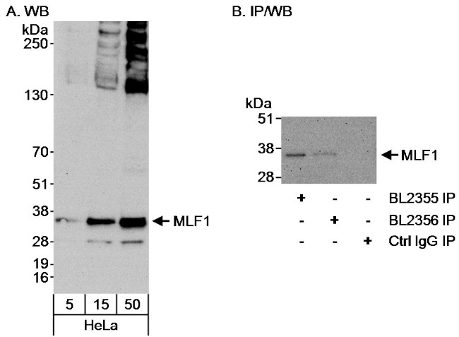 MLF1 Antibody in Western Blot (WB)