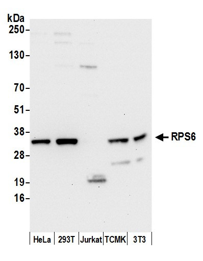 RPS6 Antibody in Western Blot (WB)