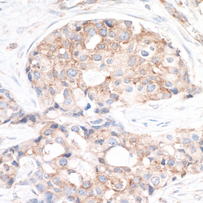 RPS6 Antibody in Immunohistochemistry (Paraffin) (IHC (P))