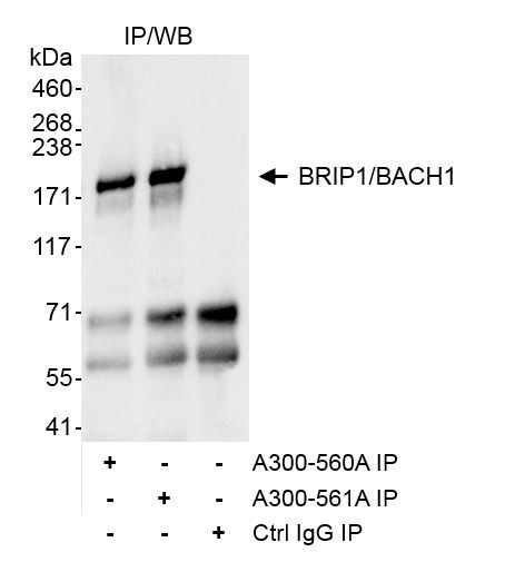 BRIP1 Antibody in Immunoprecipitation (IP)
