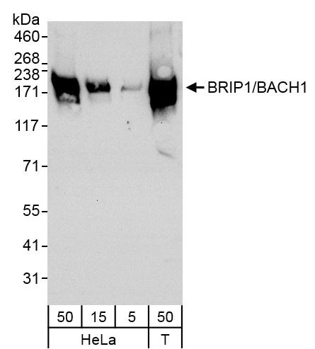 BRIP1 Antibody in Western Blot (WB)