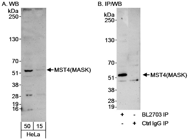 MST4/MASK Antibody in Western Blot (WB)