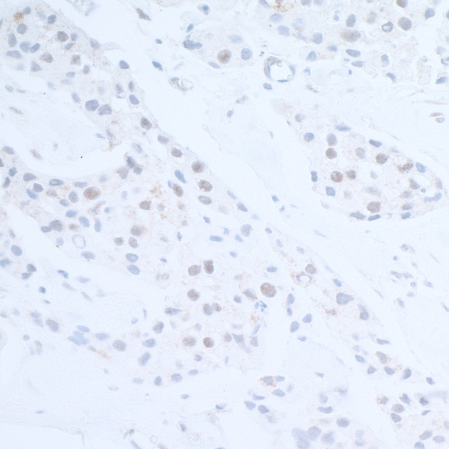 EDD1 Antibody in Immunohistochemistry (Paraffin) (IHC (P))