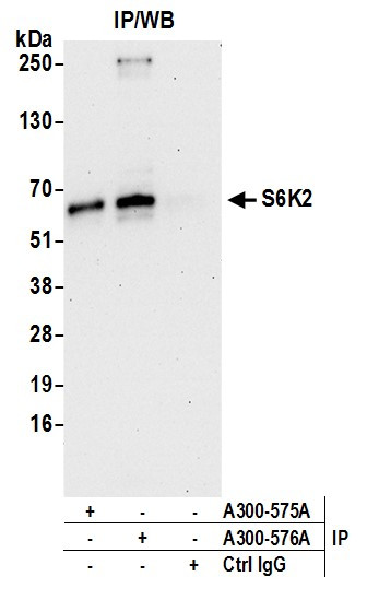 S6K2 Antibody in Immunoprecipitation (IP)