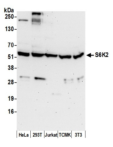 S6K2 Antibody in Western Blot (WB)