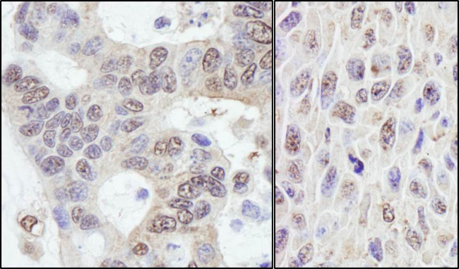 PRKRIR Antibody in Immunohistochemistry (Paraffin) (IHC (P))