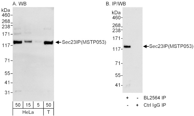 Sec23IP/MSTP053 Antibody in Western Blot (WB)