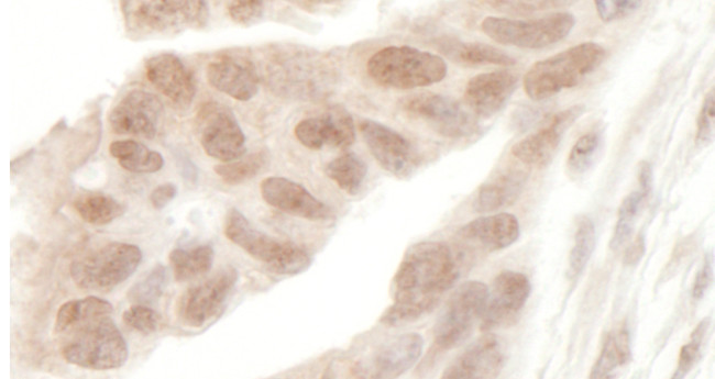 AF9 Antibody in Immunohistochemistry (Paraffin) (IHC (P))