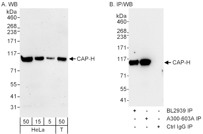 CAP-H Antibody in Western Blot (WB)