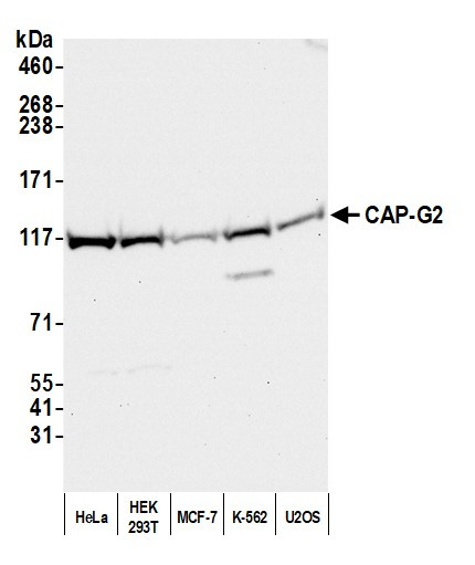 CAP-G2 Antibody in Western Blot (WB)