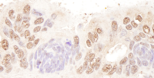 BTF Antibody in Immunohistochemistry (Paraffin) (IHC (P))
