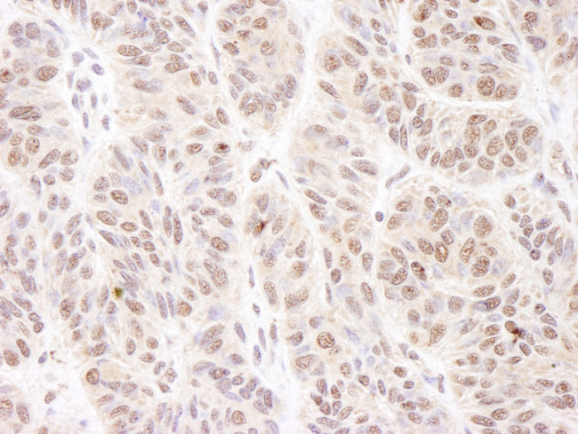 BTF Antibody in Immunohistochemistry (Paraffin) (IHC (P))