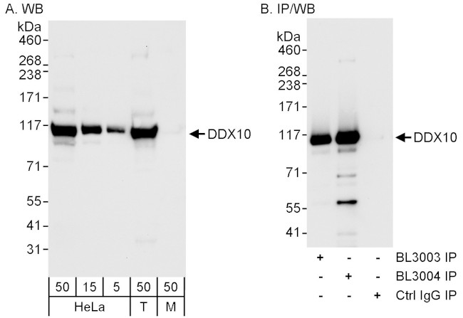 DDX10 Antibody in Western Blot (WB)